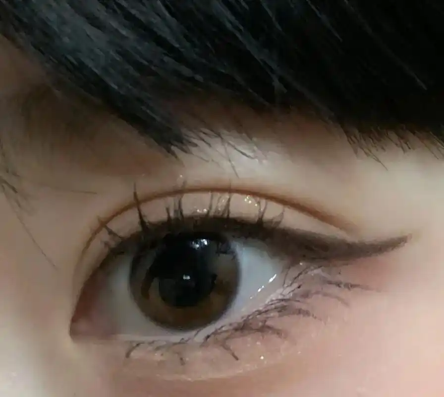 眼睑下至  #希望能帮到有需要的人 - 抖音