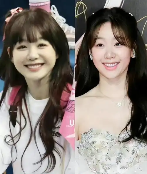 但值得注意的是,娱乐圈中牙齿整形失败的案例并非仅限于明星.