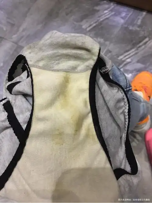 请问这样的分泌物是正常的吗?