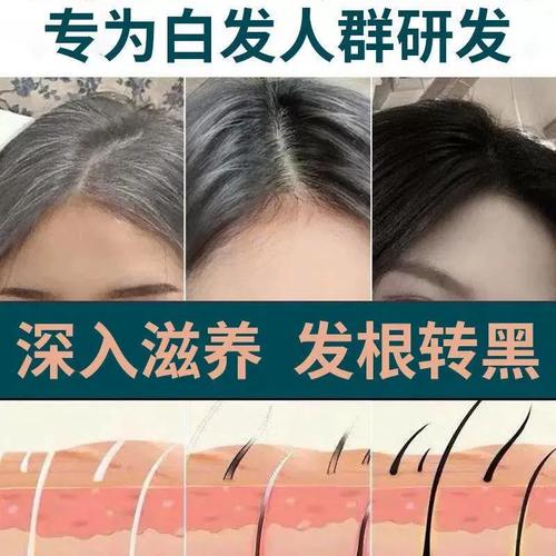 白头发克星何首乌白发转黑变黑草本养发液防脱育发增发密发乌发液