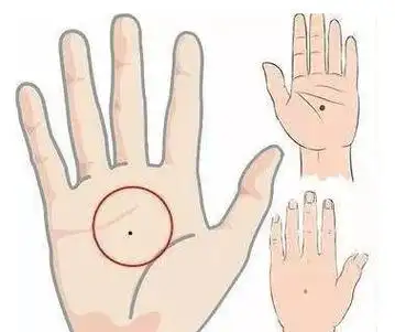 手掌有痣代表什么意思,女人左手手掌有痣代表什么意思-周易算命网