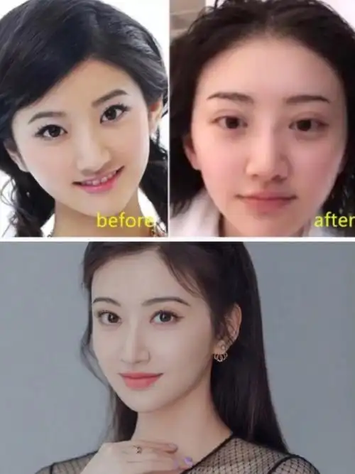 欧式大平行变窄,景甜颜值高峰期78前几年受网红审美影_圈子-新氧