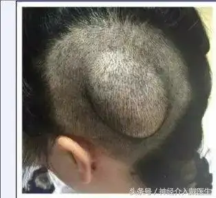 头上长包块了要不要紧? - 好大夫在线