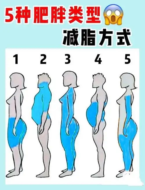 5种肥胖类型的特征燕教授附上一周的减脂运动计划赶紧收藏
