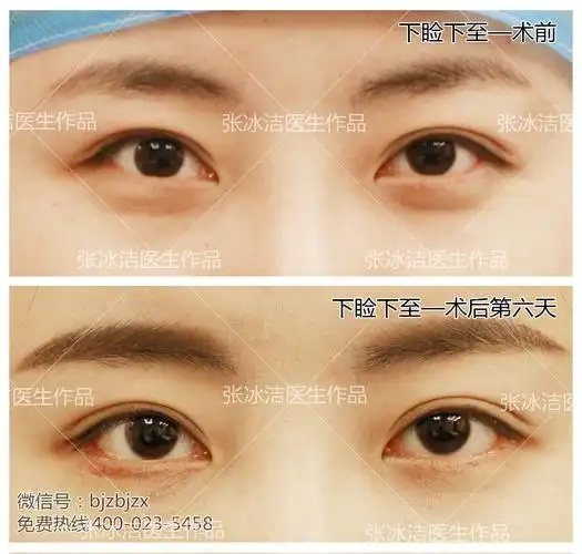 你不知道的【下睑下至】妙用