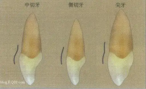 天然牙cej附近的突度在中切牙最强,尖牙次之,侧切牙基本为平坦状态