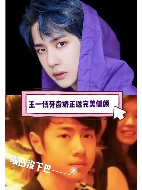 王一博拼乐高还准备用牙拆?牙齿矫正完可不能这么用!