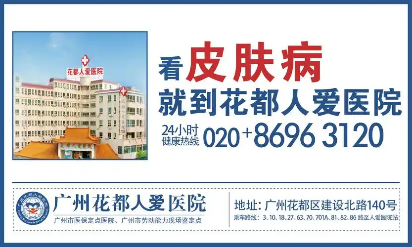 广州仁爱医院皮肤科户外广告展板
