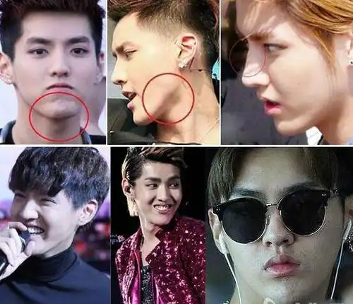 吴亦凡整容了吗 吴亦凡整容对比照首曝光