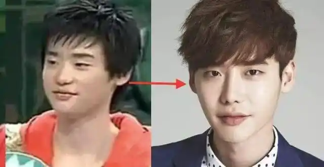 孙怡直播暴露整容铁证,以后再也不会撞脸李沁了