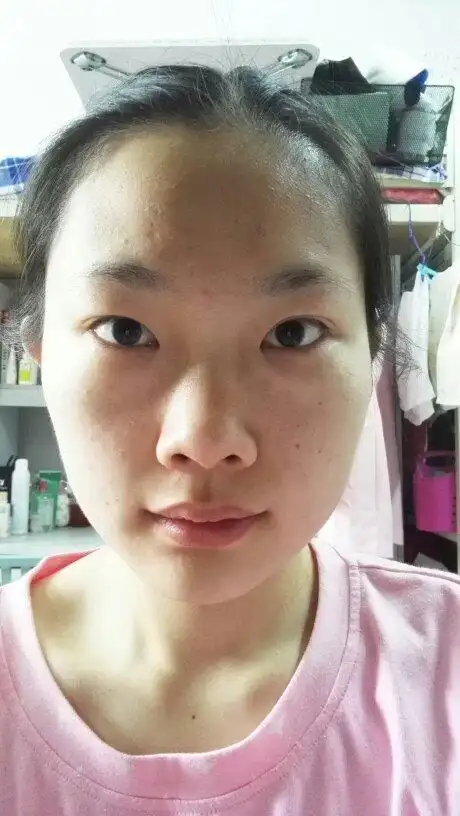 有很多小细包和红点(我是大学生,22岁,女生,混合性皮肤) 求大