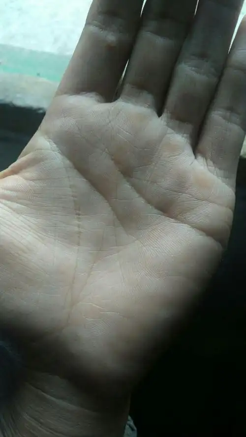 左手生命线有岛纹,还很大打师帮我看看