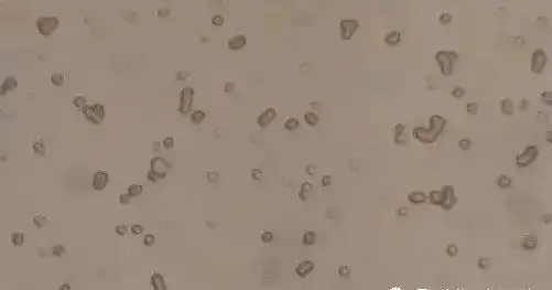 解析交叉配血中常见的凝集反应