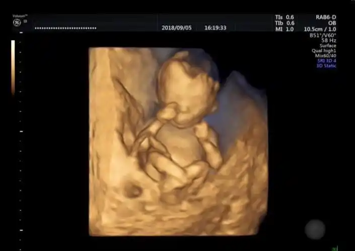 南华县人民医院科普专栏第6期—孕期超声检查_胎儿