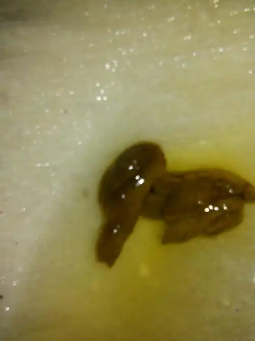 这样大便形状颜色正常吗?有没有凹槽呢