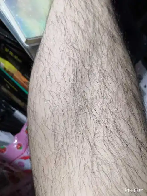 腿毛太长是一种怎么样的体验?