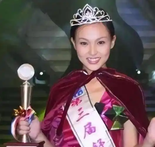 唐嫣23年前旧照曝出,发际线高的快赶上杨幂,整没整容一目了然!