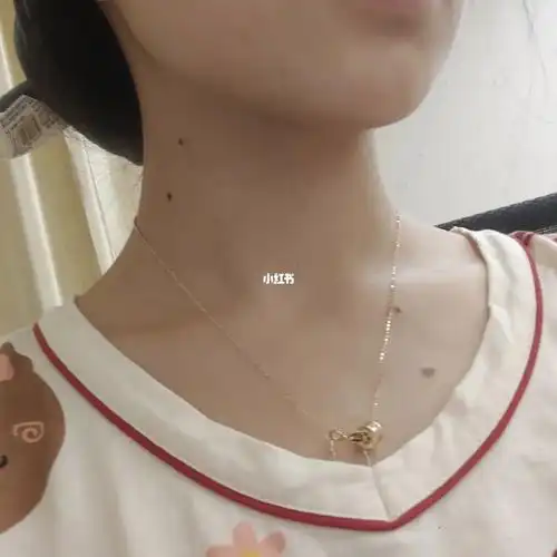 不知道什么时候长的痣还都是成双成对长的左脖子一对右锁骨一对还有