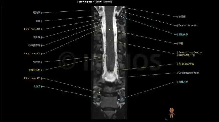 颈椎mri解剖图(轴向,冠状,矢状切片)