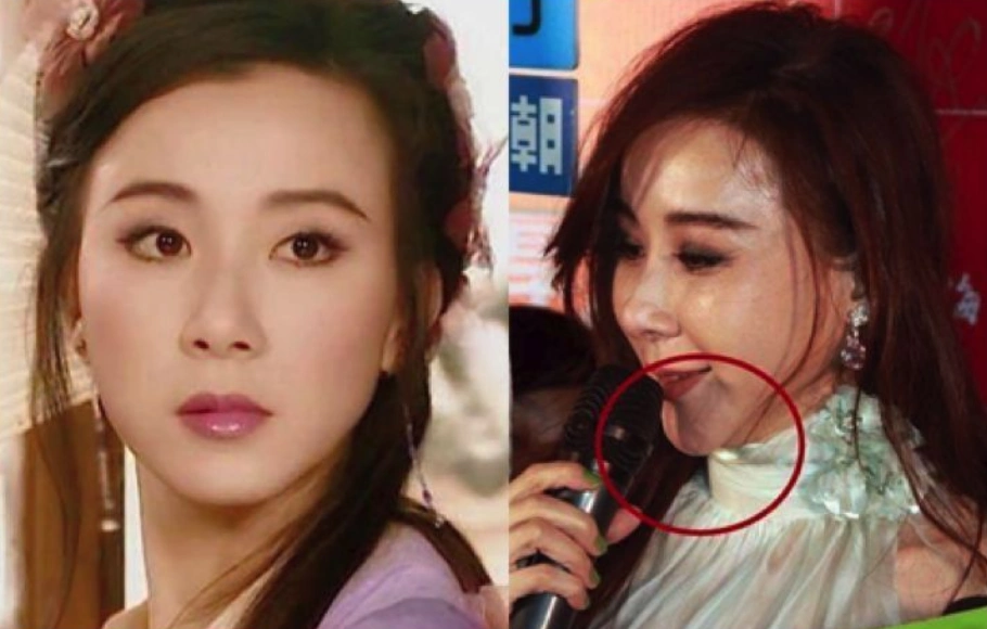 盘点9位整过容不自然的女星:第一位葬送事业,最后一位吓坏众人