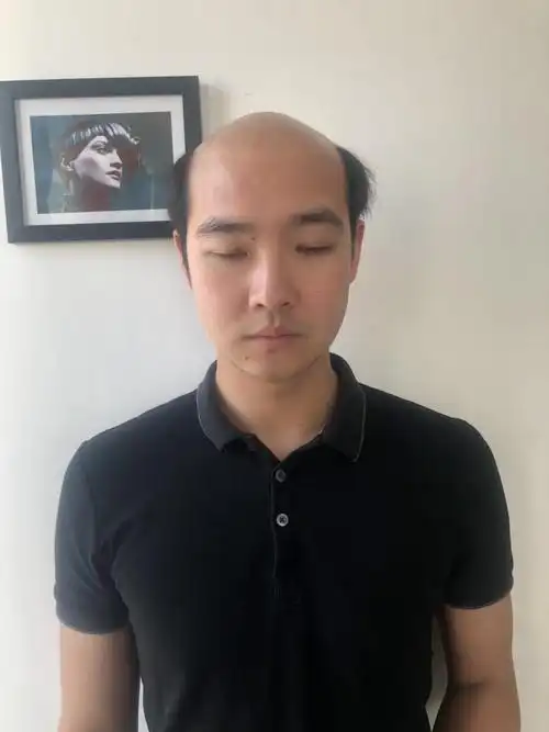 发际线高寸头好看吗