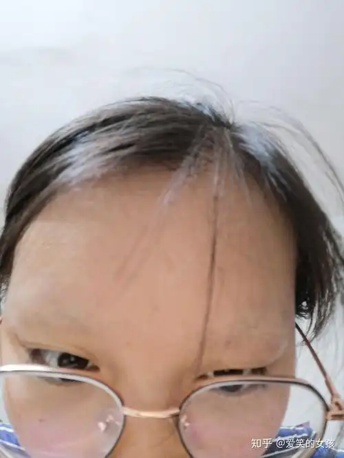 剃眉毛的第七天