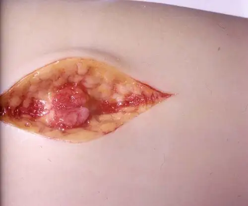 thumbs young pussy fucking outside hairy teen bit