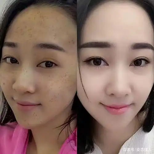 蜂蜜加它敷脸,美白淡斑居然有奇效?已经强势被女生安利了!