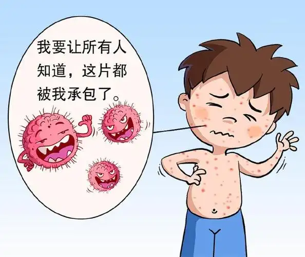 经2~3周潜伏期后,皮肤(以躯干处较常见)陆续出现斑丘疹,水疱疹,有的