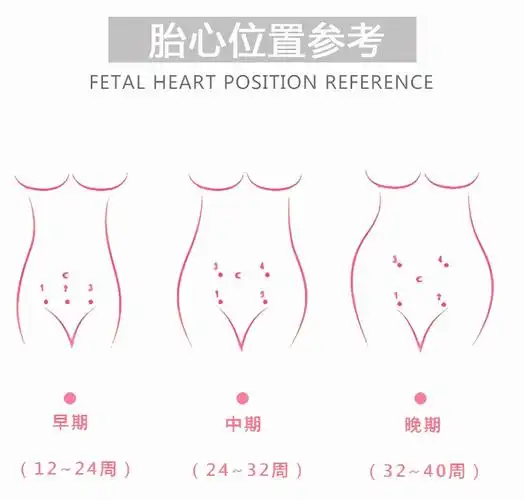 胎心位置规律如下:(a) 6个月前,胎心位置常在脐下腹部中线正中或两侧.