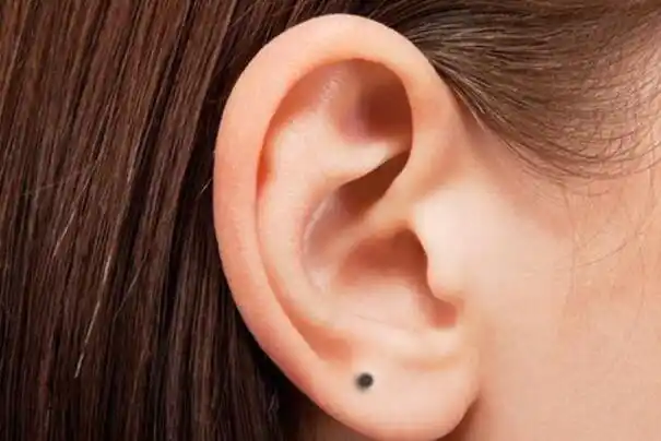 耳垂上长痣的人财运极佳为人忠厚健康长寿身体无虞