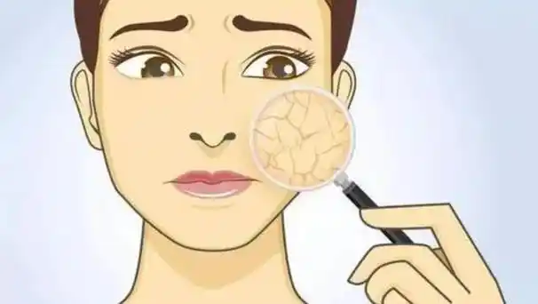 皮肤很粗糙是什么原因(皮肤为什么会粗糙该如何改善)(6)