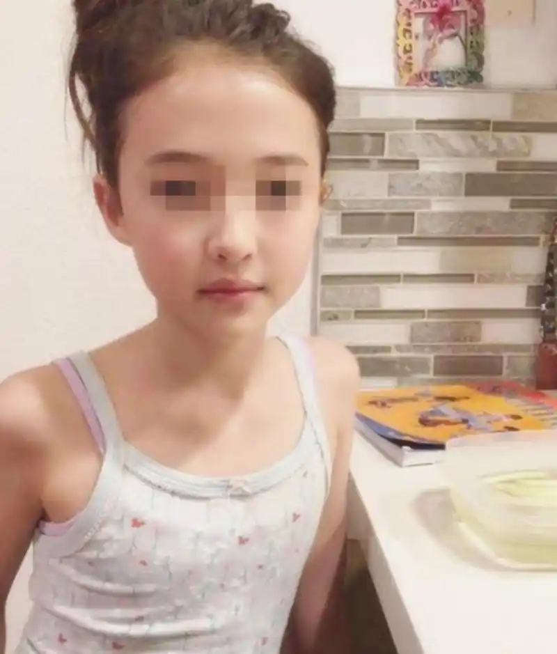 7岁小姑娘,胸部胀得难受,开始长腋毛,去医院检查,医生发现小姑娘双乳