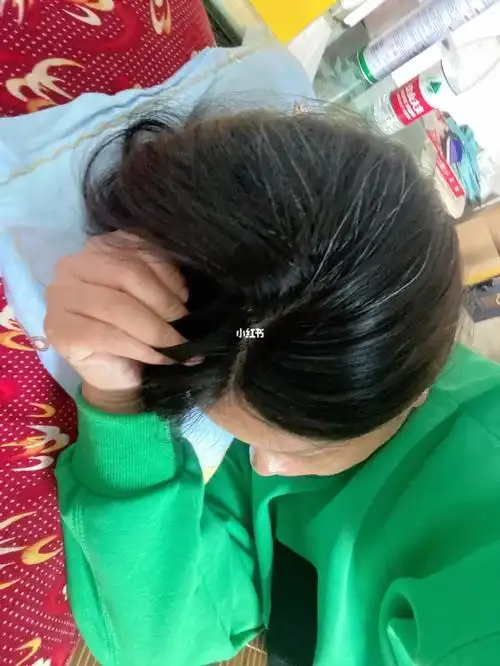 头发本来有好多白的!这怀孕吧又涨了好多!