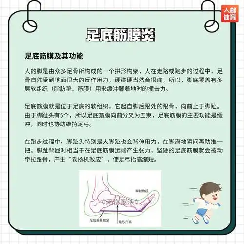 足底筋膜炎