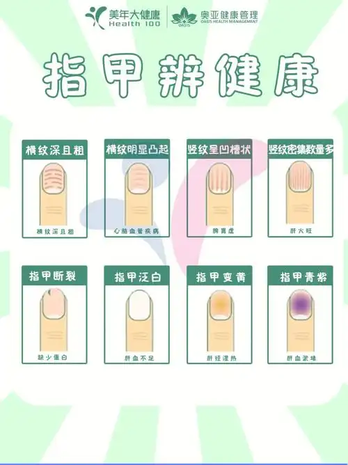 手指甲的颜色和状态其实都直接反映着人体的健康状态比如手指上的纹路