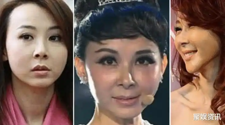 5位整容失败的明星,第3位差点毁容,最后一位整容成"巫婆"!