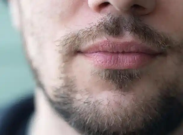 早上刚刮了胡子,隔早就长出来了,胡子长太快,意味着什么?