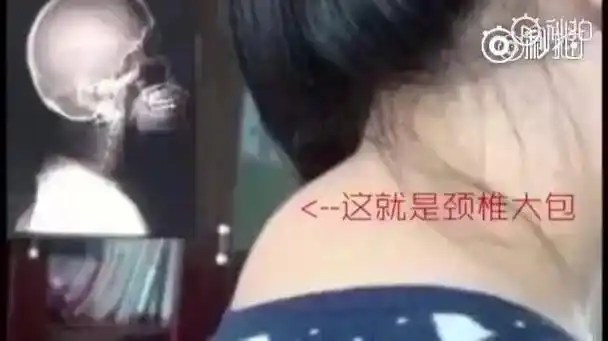 日常分享2分钟教你矫正颈椎大包一套矫正操瘦脖子瘦肩膀坚持就能看到