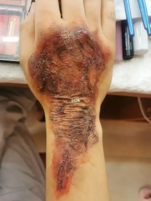 逼真的特效～#特效化妆师 #烧伤 #特效妆