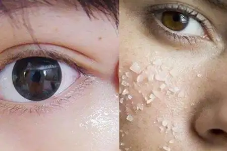 皮下脂肪颗粒怎么消除 这些小妙招你是否已经学会