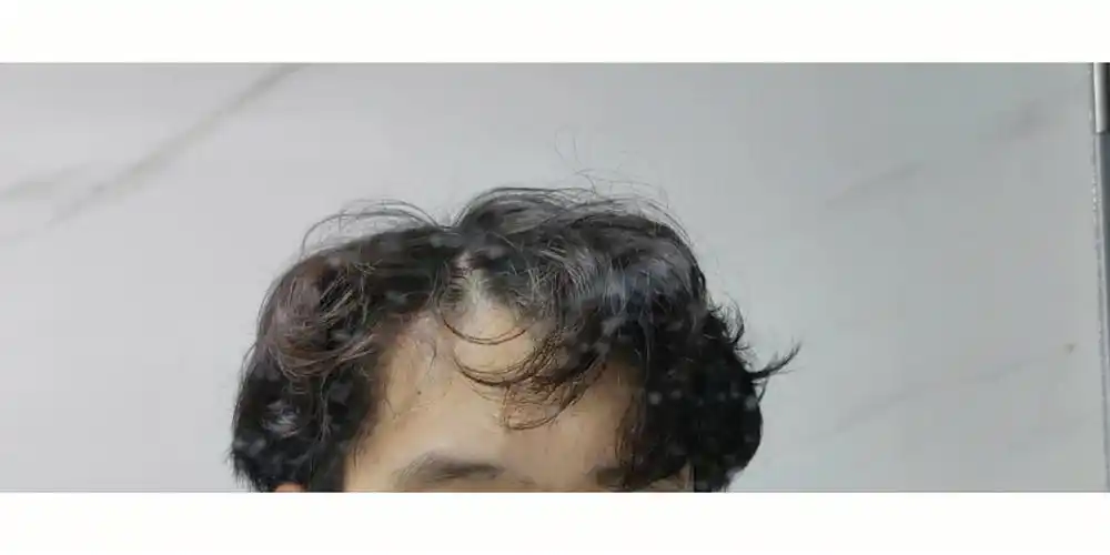 就成了这样,以后不会再烫头了#烫头  #烫头失败  #烫头翻车  #纹理烫