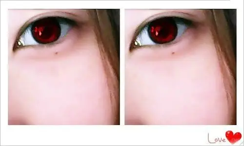 我这个是泪痣吗