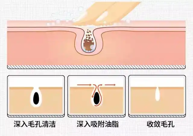 深入毛孔清洁,深入吸附油脂,收敛毛孔多孔性结构升级吸附力大量碳含量