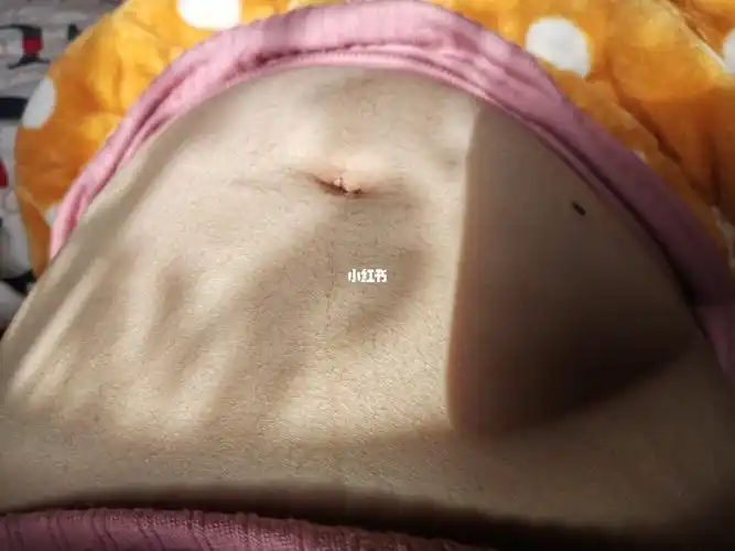 17肚子上有毛毛