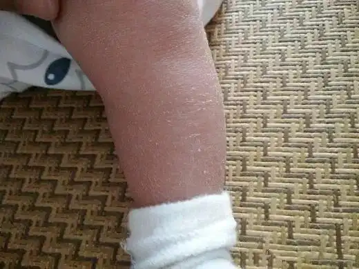 丞老师大讲堂聊聊宝宝四肢爱抖动这件事儿