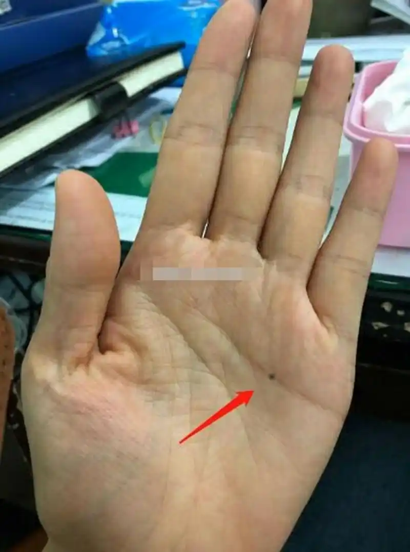 感情线上有痣的手相并不常见,毕竟掌上有痣的概率已经相当低了.
