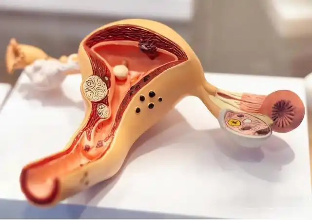 失去子宫的女人,与正常女性有什么不同?还可以过夫妻生活吗?