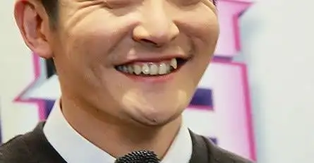 4位男艺人的虎牙只有一张是王俊凯的真爱粉的你能几秒找到呢