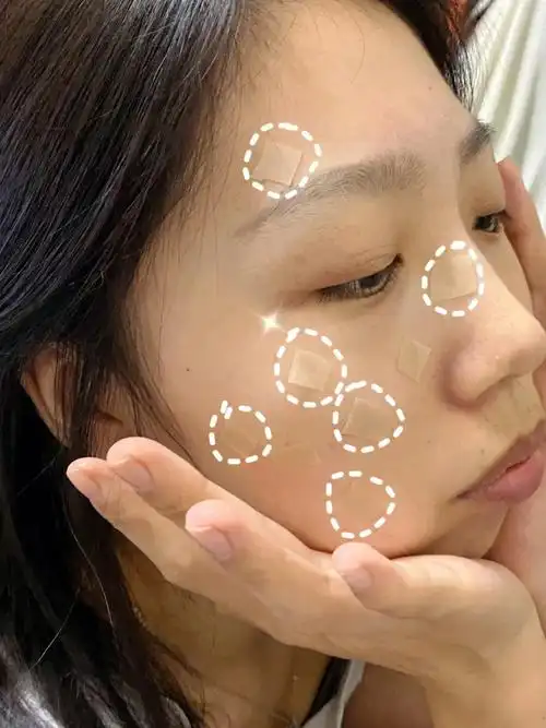 妈耶这个去痘印的方法真的顶